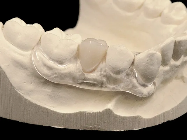 Flexprovisorium